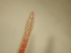 Oligochaeta 3